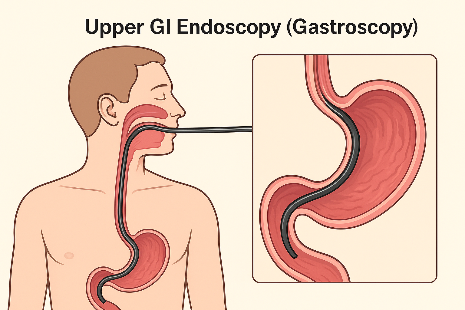 Upper GI Endoscopy